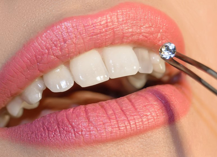 Tooth Jewelry